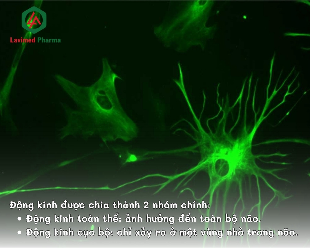 Động kinh được chia làm 2 loại chính là toàn thể và cục bộ