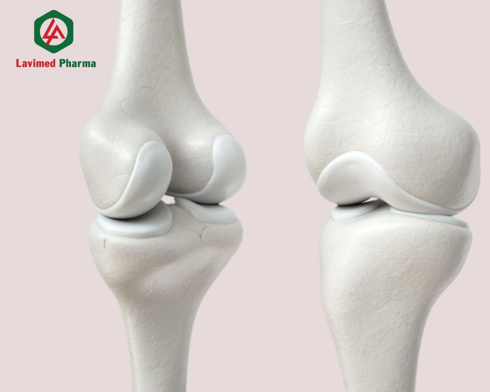 Sức khỏe sụn khớp
